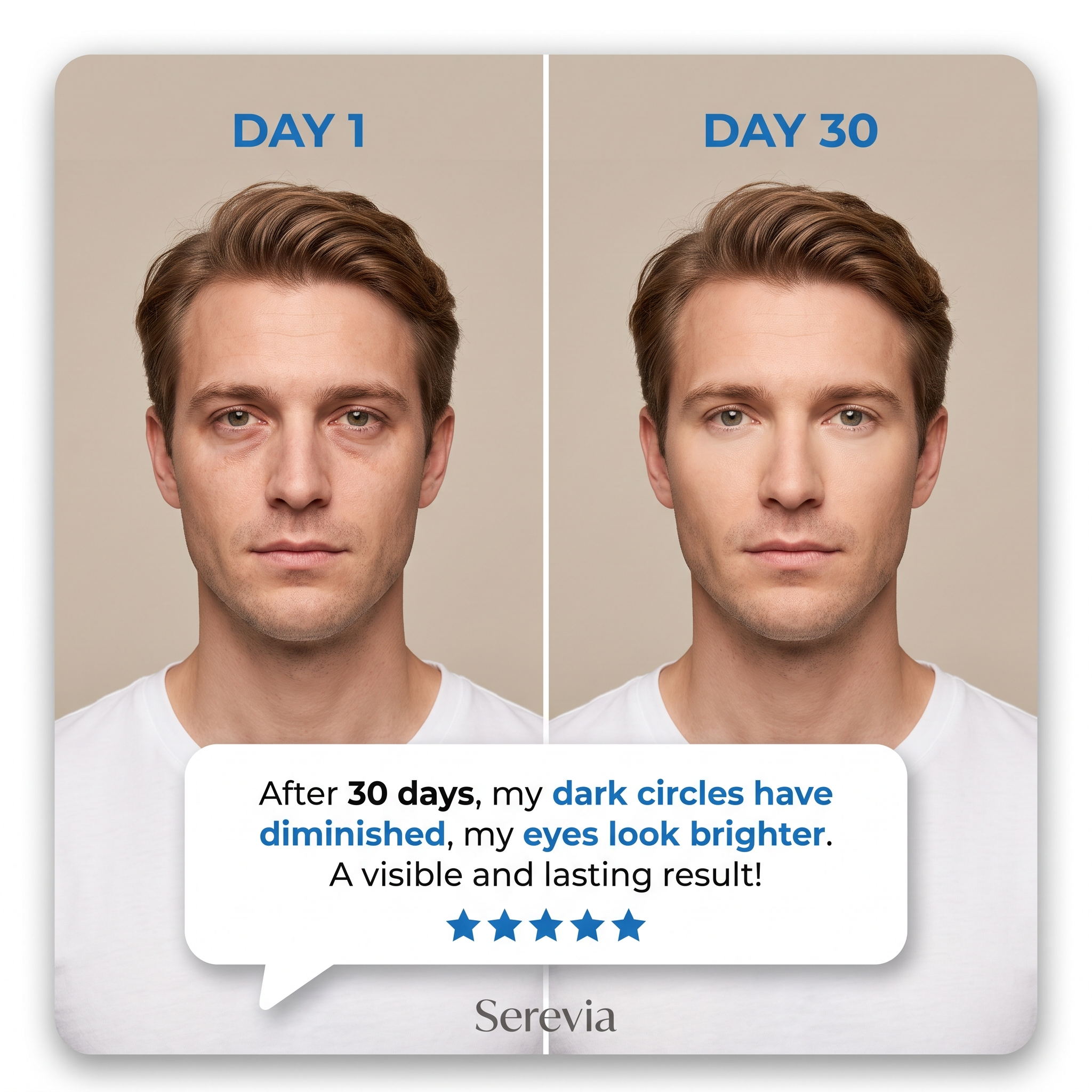 Serevia Cortisol Manager
